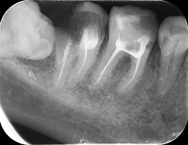 Seven and eight - Teeth, Dentistry, Disgusting eight