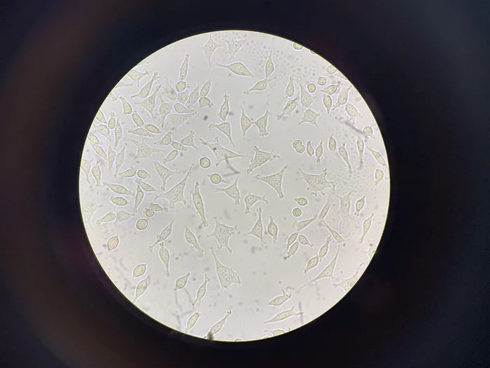 Fibroblast line L929 - My, Biology, Living cells, Microscope, Microscopy