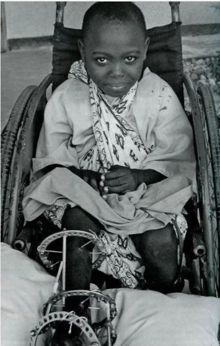 Гавриил Абрамович Илизаров Врачи, Медицина, Аппарат Илизарова, Илизаров, Курган, Кости, Длиннопост Гавриил Абрамович Илизаров Врачи, Медицина, Аппарат Илизарова, Илизаров, Курган, Кости, Длиннопост