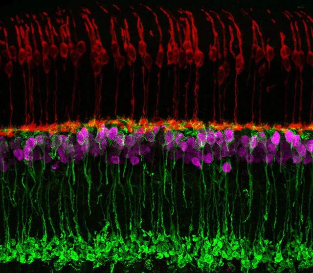 Human cells restore sight to mice - Vision, Ophthalmology, Retina, The medicine, The science, Research, Science and life, Restoration of vision, Interesting, Informative, Longpost, Mouse, Eyes, Treatment, Experiment