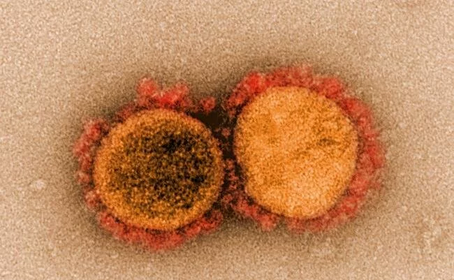 Исследователи установили структурные детали того, как SARS-CoV-2 обходит иммунитет Перевод, Медицина, Коронавирус, Здоровье, Вирус, Микробиология, Длиннопост
