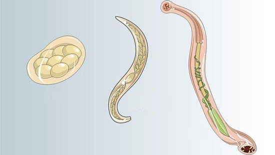 LEGLESS #10 - My, Worm, Worms, Parasites, Roundworms, Mat, GIF, Longpost