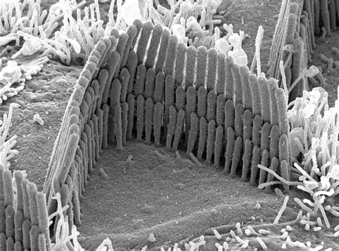 What turns sound into a nerve impulse - Anatomy, The medicine, Hearing, Interesting