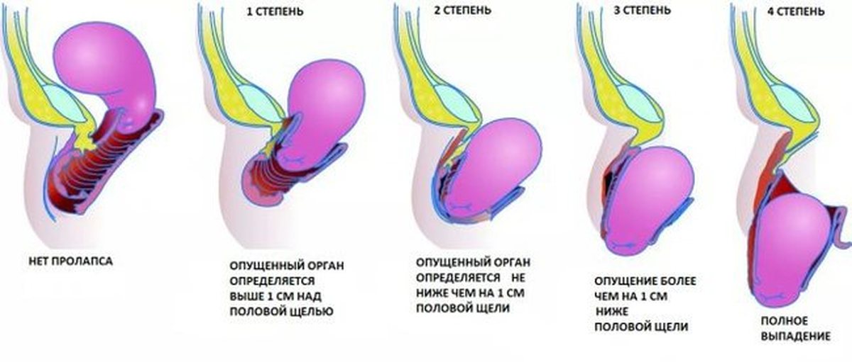 Steoh Kegels