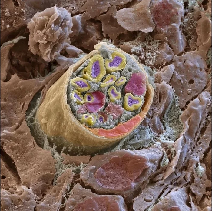 peripheral nerve - Person, Interesting, Anatomy, Microfilming