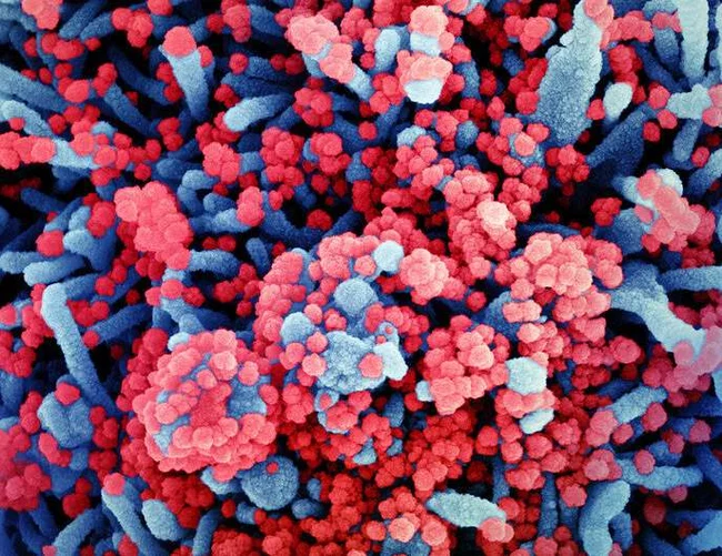 Учёные случайно обнаружили мутацию, позволяющую коронавирусу заражать клетки принципиально новым способом Перевод, Коронавирус, Медицина, Вирус, Эпидемия, Длиннопост