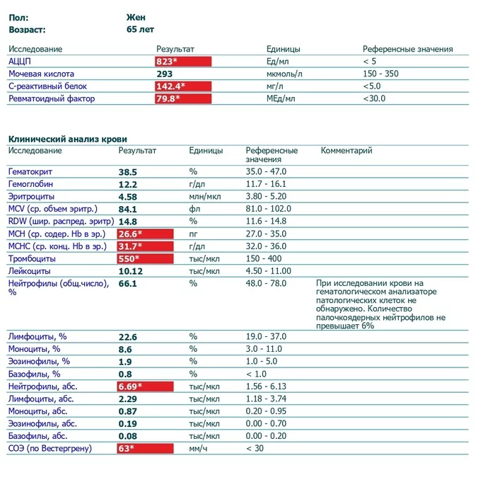 Need medical help - My, No rating, Medical tests, Doctors need help, Diagnosis