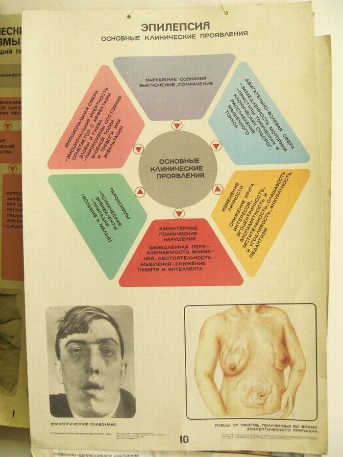Epilepsy - a poster from a Soviet hospital - Epilepsy, Poster, Seizure, the USSR, The medicine, Disease, Burn