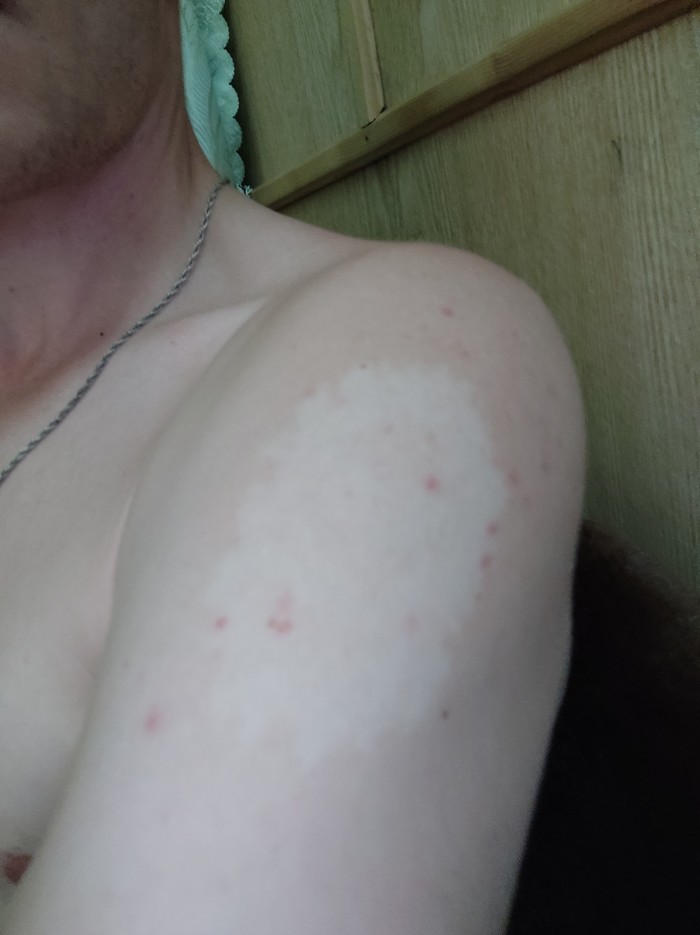 Как можно разыграть антипрививочников