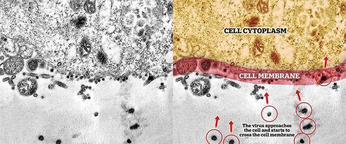 Scientists have shown the moment of infection with coronavirus under a microscope - Interesting, The medicine, Microfilming, Coronavirus