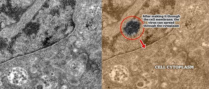 Scientists have shown the moment of infection with coronavirus under a microscope - Interesting, The medicine, Microfilming, Coronavirus