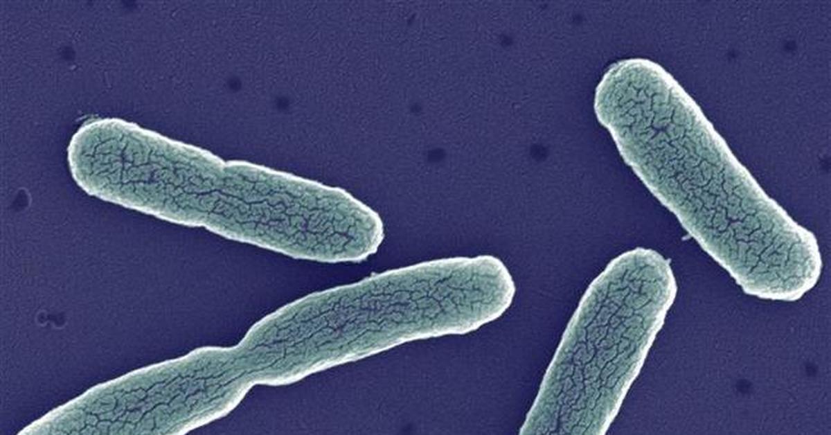 coli bacteria - Interesting, Microfilming, Microbes, E. coli, Bacteria