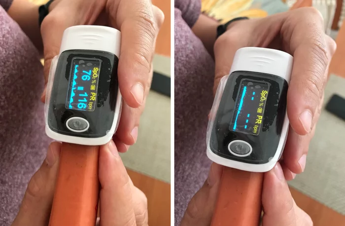 Response to the post Chinese pulse oximeter tested on an overripe banana - My, pulse oximeter, Sausages, , Coronavirus, Reply to post