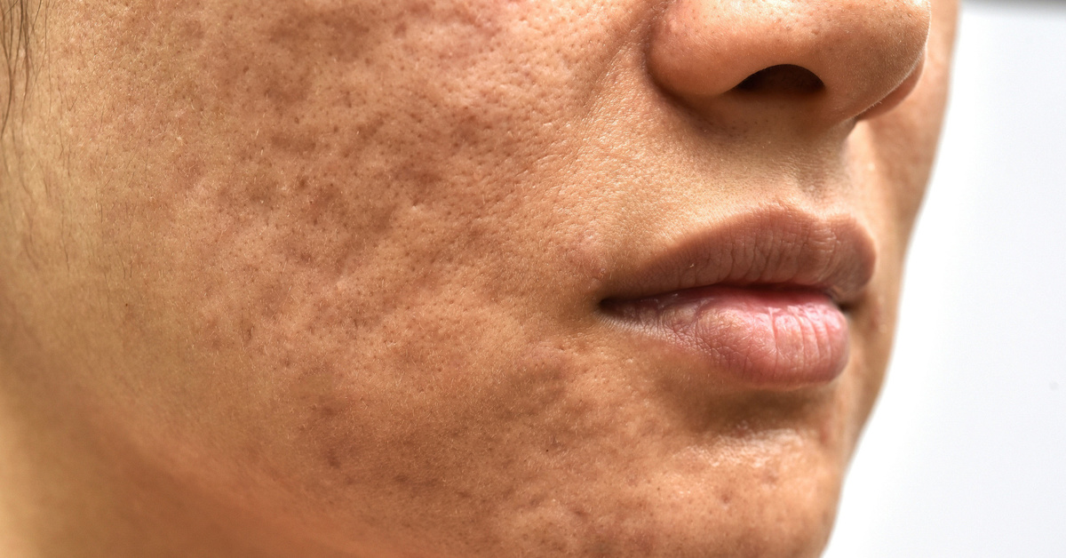 Девушка с перерезанным горлом. Человек в моей коже. Человек в моей коже. Кожа в которой я живу кадры. Кожа, в которой я живу / la piel que habito (2011).