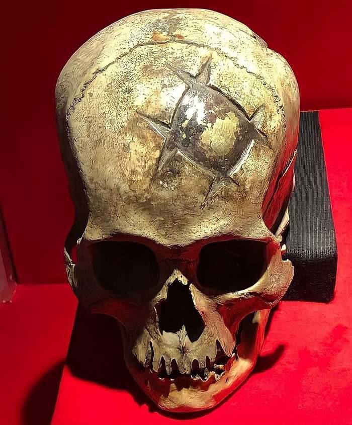 Inca skull with over 500 year old gold plate implant found in Peru - Peru, Operation, Scull, The medicine, Trepanation of the skull
