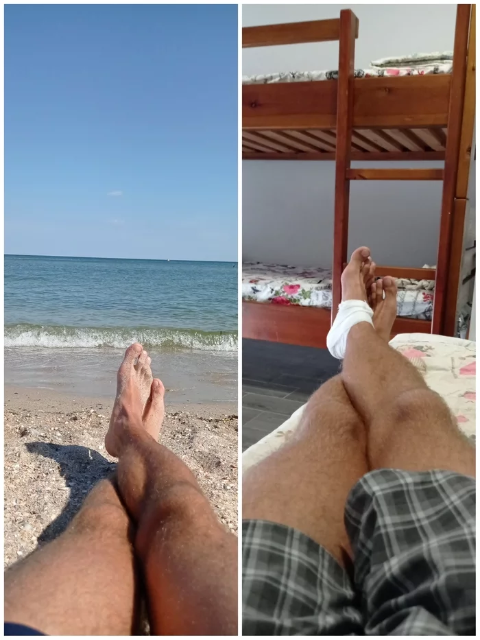 Relaxation - My, Relaxation, Injury, Beach, Sand, Wound, Zatoka, Accident