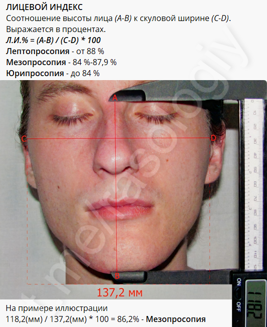 An Illustrative Example of Anthropometric Measurements - My, Racology, Anthropology, Racial studies, Anthropometry, Biometrics, Longpost