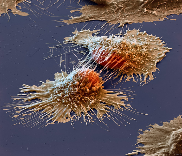Белок-регулятор вызывает мутации и в стволовых, и в раковых клетках Белок, ДНК, Мутация, Раковые Клетки, Стволовые клетки, Длиннопост