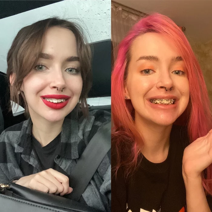 How I got rid of a complex of crooked teeth PART 2 - My, Teeth, Braces, Cosplay, Longpost