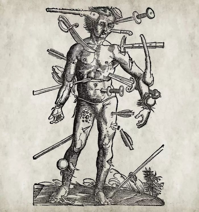 Wound Man from Hans von Gersdorff's Feldtbuch der Wundartzney [1519] , , 