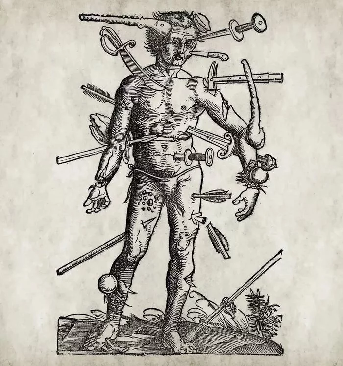 Wound Man from Hans von Gersdorff's Feldtbuch der Wundartzney [1519] - Story, Painting, Vintage