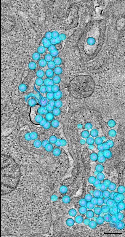 Our internal troops: an elusive enemy - My, Immunity, Hiv, The medicine, Immunology, Video, GIF, Longpost