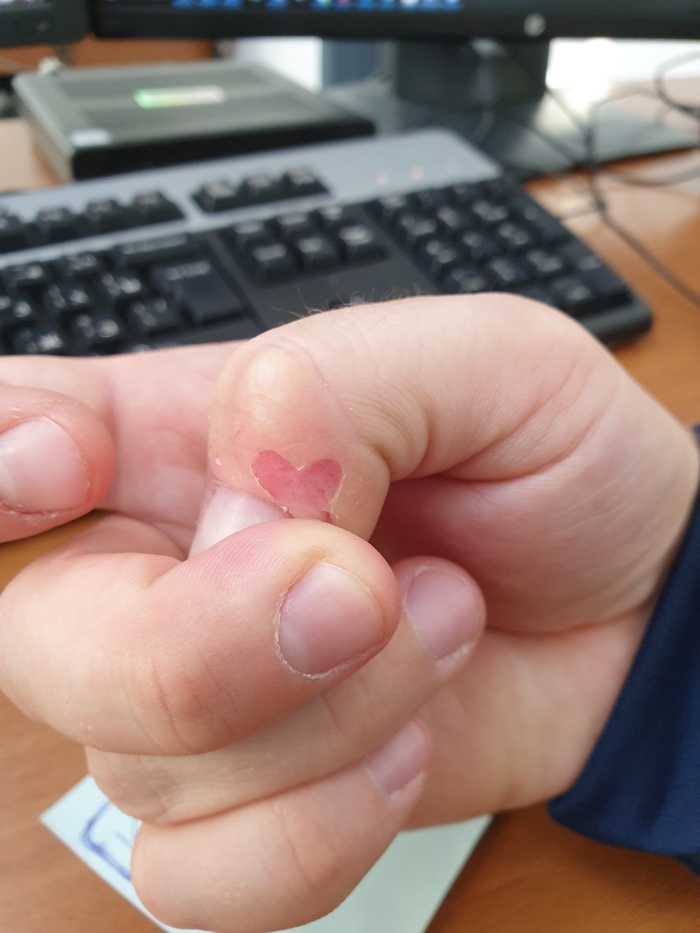 Заусенец, оторванный с любовью