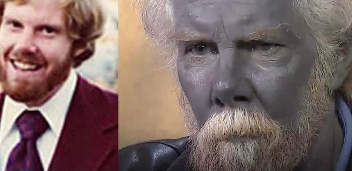 Man drank homemade colloidal silver for 20 years and turned blue - Reddit, Mood color blue, Longpost, Silver, Blue, Obscurantism, Self-medication