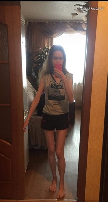 I feel like my strength is leaving me. A girl from Ulyanovsk after covid begs doctors for help - Ulyanovsk, Ulyanovsk region, Help, Ministry of Health, Doctors, Repost, Strong girl, news, , Coronavirus, Longpost, No rating, Negative