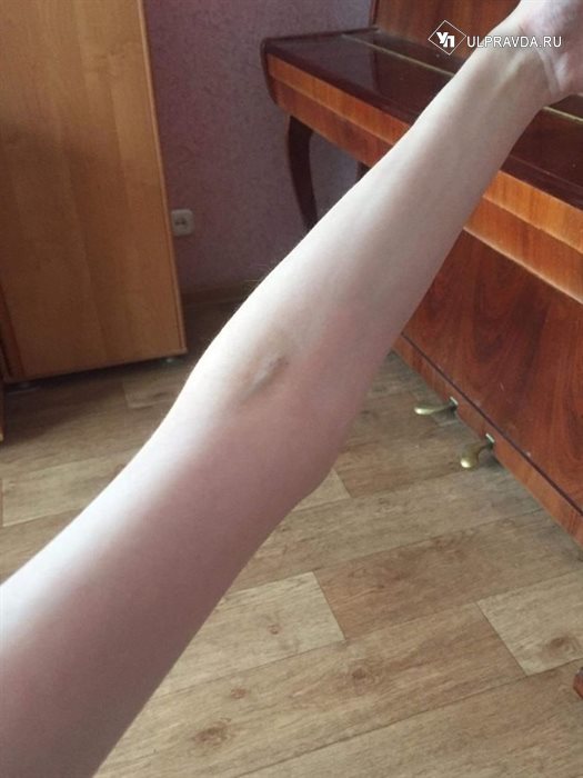 I feel like my strength is leaving me. A girl from Ulyanovsk after covid begs doctors for help - Ulyanovsk, Ulyanovsk region, Help, Ministry of Health, Doctors, Repost, Strong girl, news, , Coronavirus, Longpost, No rating, Negative