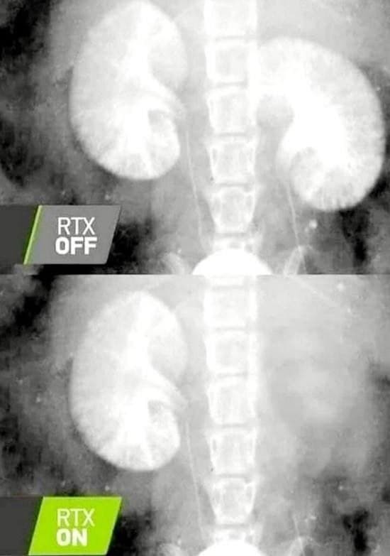 RTX - Видеокарта, Цены, Прайс, Почки, Юмор, Рентген, Черный юмор