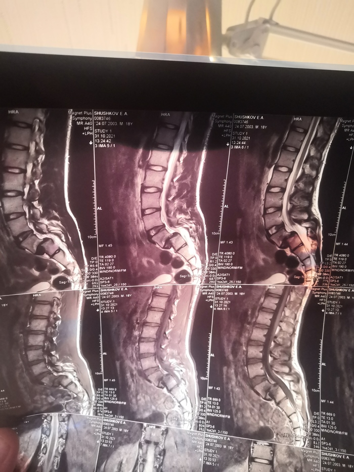 ��������� ������� ������