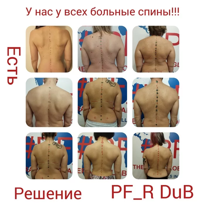 PF_R and PF_R_DuB - My, FIU, Back, Neuralgia, Pain, Unlocking, Osteochondrosis, Osteopathy, Therapy, Video