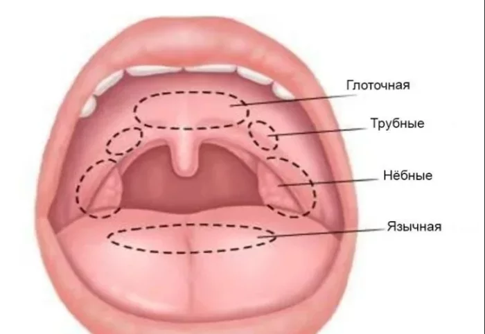 New strain of coronavirus? - My, Coronavirus, Vaccination, Disease, Throat, Tonsils, Satellite V, Mystery, Longpost