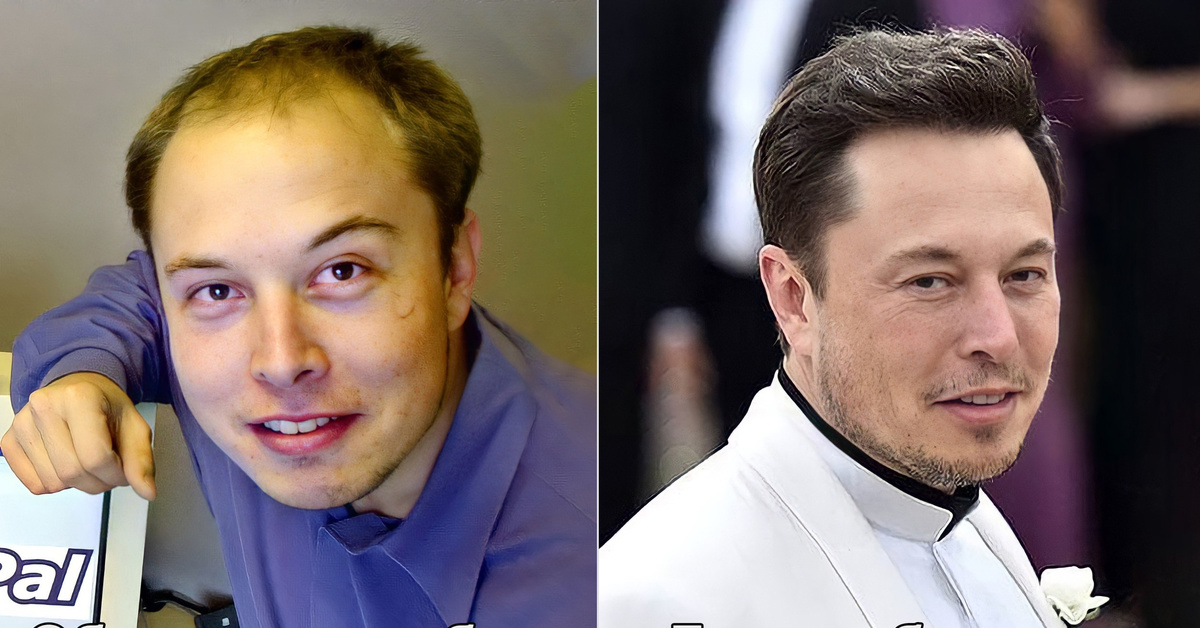 Дуров в молодости и сейчас. Elon Musk в молодости. Илон Маск лысый. Элон Маск до пластики.