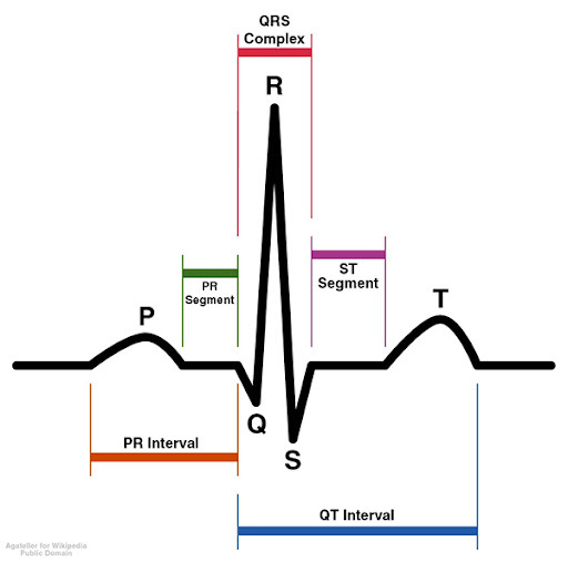 ECG acquaintance - My, Informative, Cognition, ECG, The medicine, Longpost