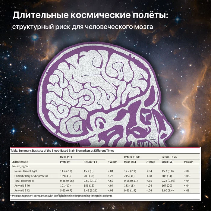 Длительные космические полёты: структурный риск для человеческого мозга - Моё, Космос, Космонавтика, Имбп, Мозг, МКС, Длиннопост