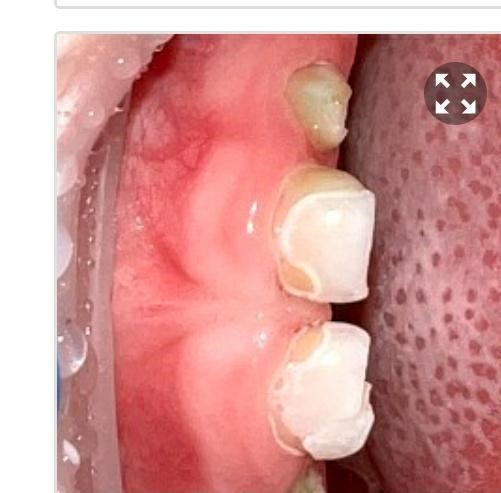 Please help. - No rating, Dentistry, Longpost