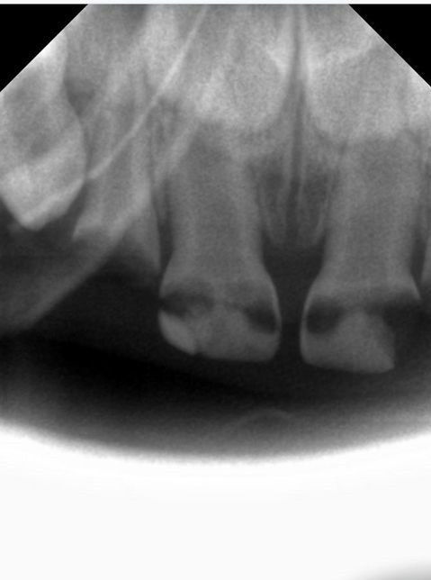 Please help. - No rating, Dentistry, Longpost