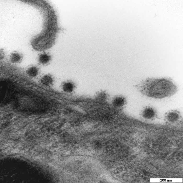 Scientists have found a previously unknown way of penetration of coronavirus into the brain - My, TASS, Coronavirus, news, Scientists, Research, Pandemic, The science, Epidemic, Media and press, Longpost