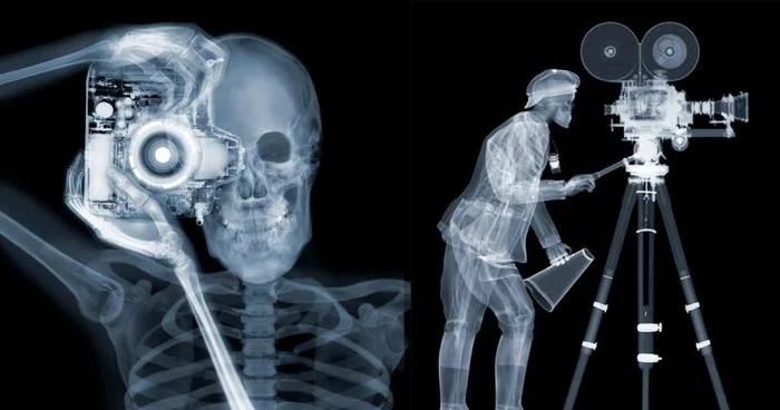 X-ray of the girl gymnast in the trough and other photo-jokes with X-rays - Humor, X-ray, Funny, Longpost