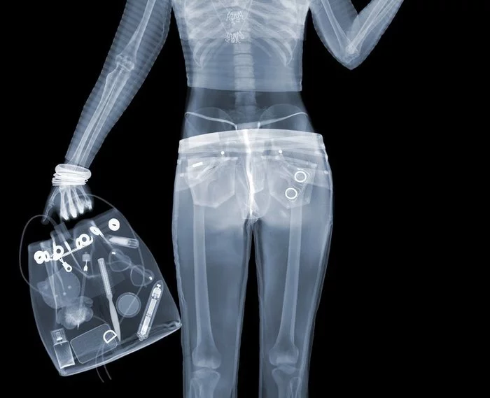 X-ray of the girl gymnast in the trough and other photo-jokes with X-rays - Humor, X-ray, Funny, Longpost