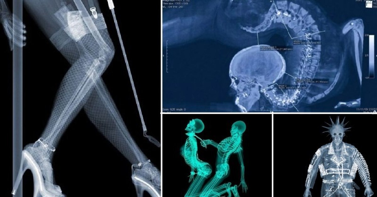 Смешные рентгеновские снимки (50 фото)