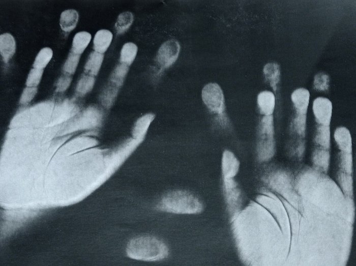 Если ваши анализы не нашли или потеряли. Звоните в лабораторию напрямую