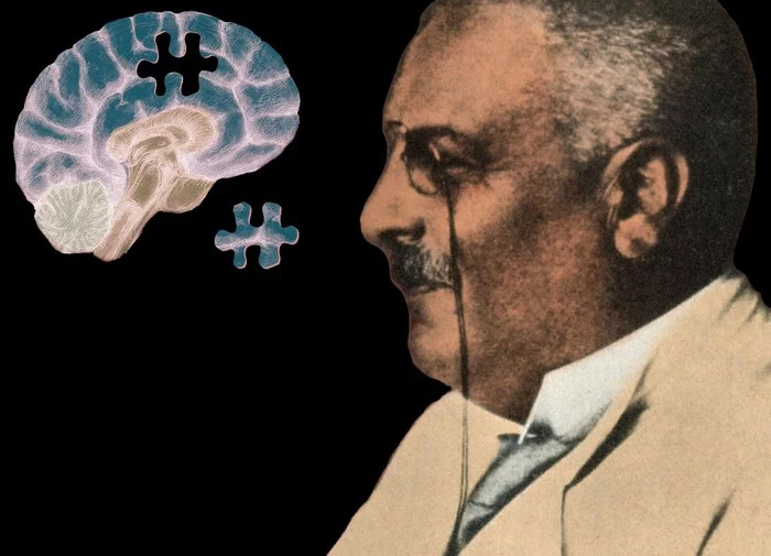 Alois Alzheimer: the man who discovered the disease - The medicine, Doctors, Disease history, Alois Alzheimer, Alzheimer's disease, Disease, Dementia, Psychiatrist, Germany, Informative, Research, Longpost