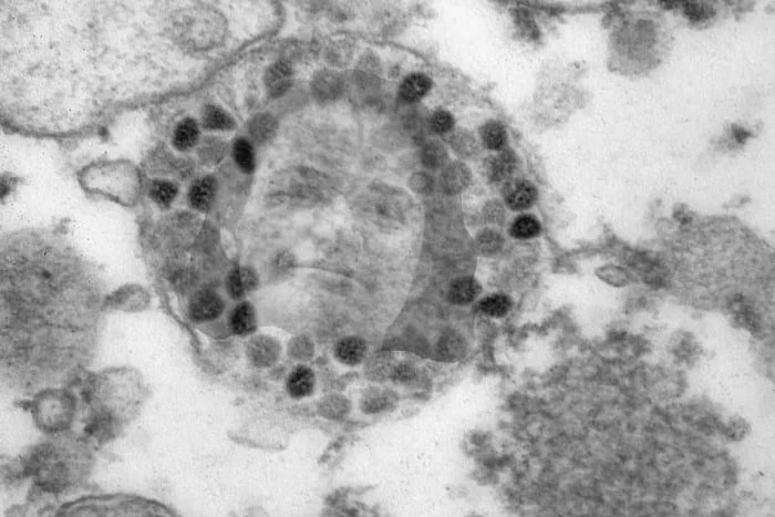 PAN Scientists * Published Photos of Omicron, a Deadly Coronavirus Strain - Republic of Belarus, Academy of Sciences, Coronavirus, Omicron, Sovbelarussia, Svetlana Tikhanovskaya, Fake news, Politics