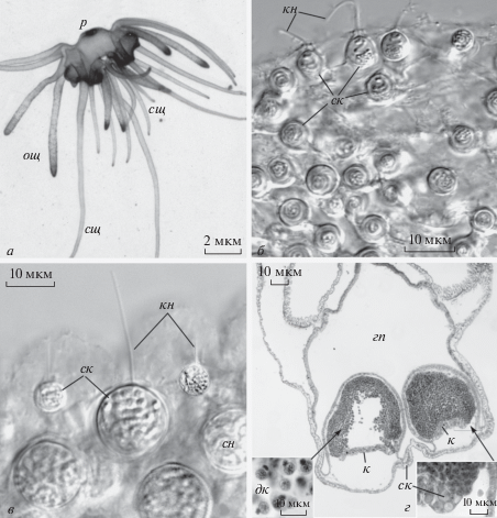 Tentacle - My, Coelenterates, Parasites, Black caviar, Mat, Longpost