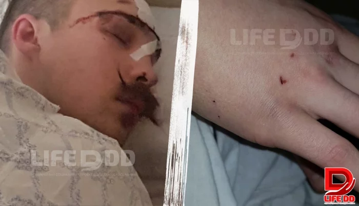 So that he doesn't call me garbage: in Moscow, the rapper got a headbutt after meeting with the police - My, Moscow, Police, Rap, Negative, news, Injury, Article, Longpost, Lifedd