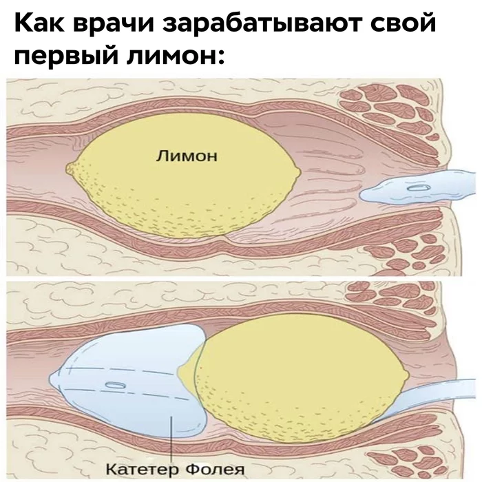 Первый лимон - Юмор, Картинка с текстом, Медицинский юмор, Проктология, Лимон, Игра слов