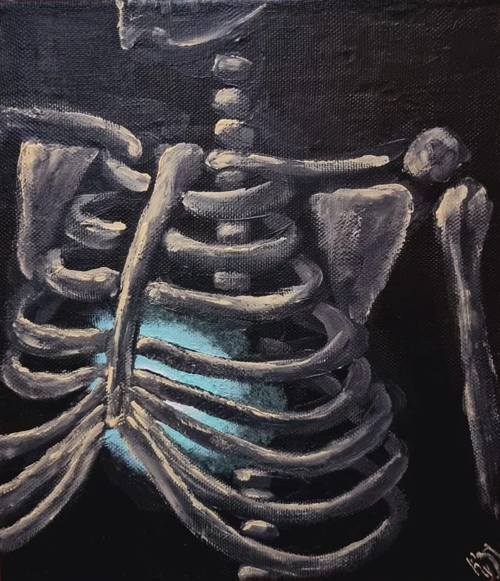 Done - My, Skeleton, Bones, Anatomy, Heart, Fire, Smoldering, Acrylic